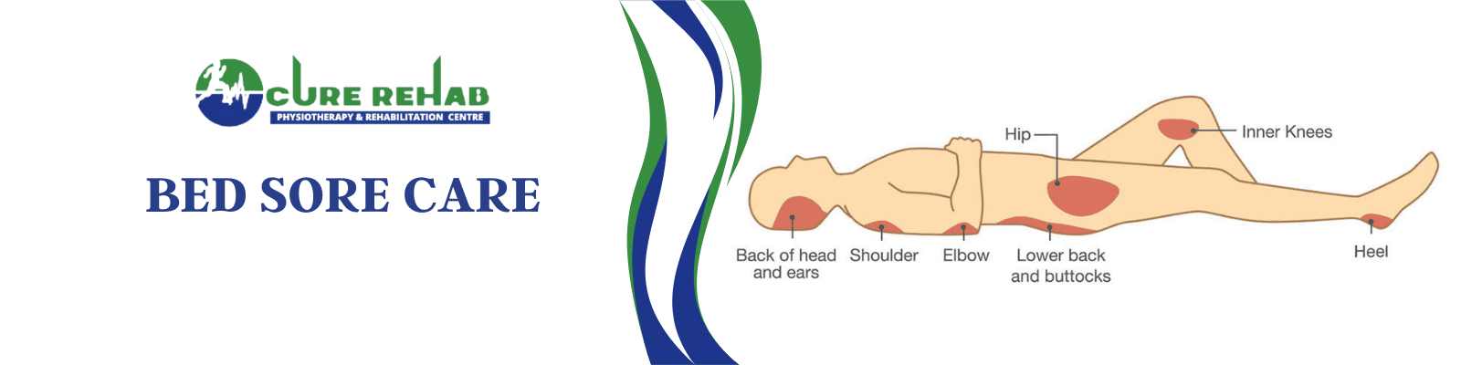 Bed Sore Care at Cure Multispeciality Rehab