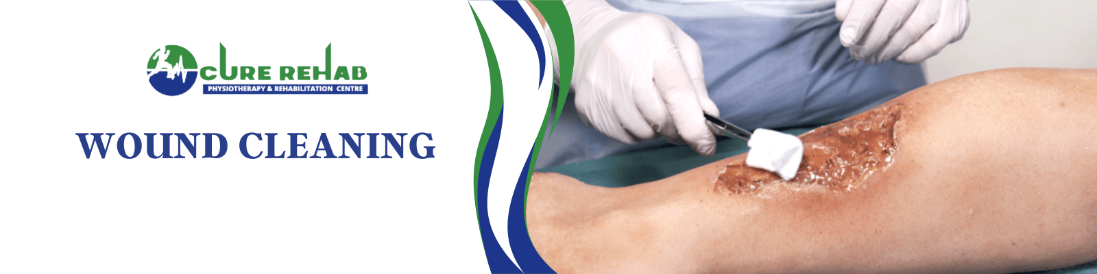 Wound Cleaning at Cure Multispeciality Rehab
