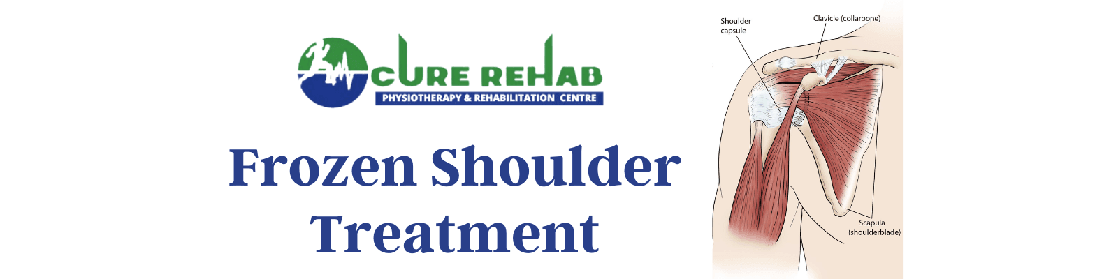Frozen Shoulder at Cure Multispeciality Rehab