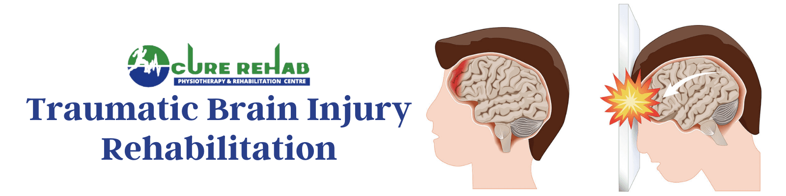 Traumatic Brain Injury Care at Cure Multispeciality Rehab