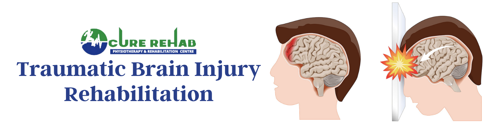 Traumatic Brain Injury Care